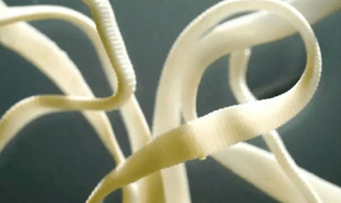 How to eliminate parasites from the human body